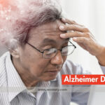 Alzheimer Disease