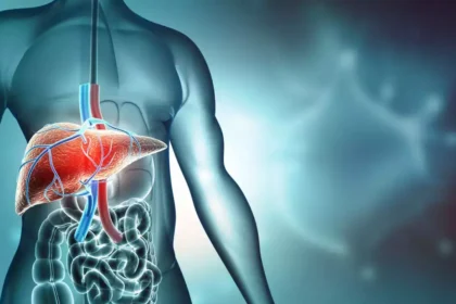 Cirrhosis of the liver