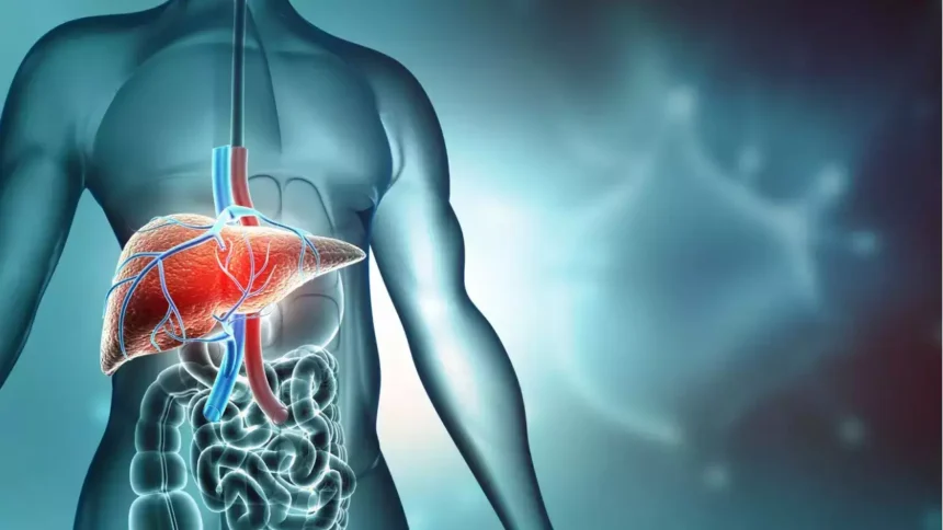 Cirrhosis of the liver