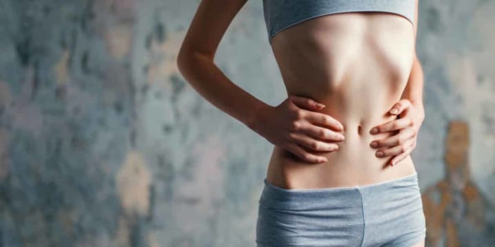 Anorexia Nervosa
