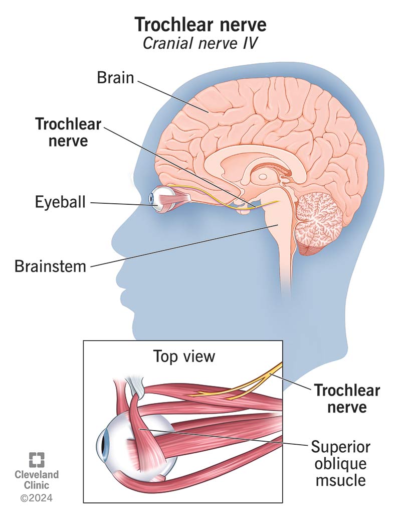 Brain Tumours