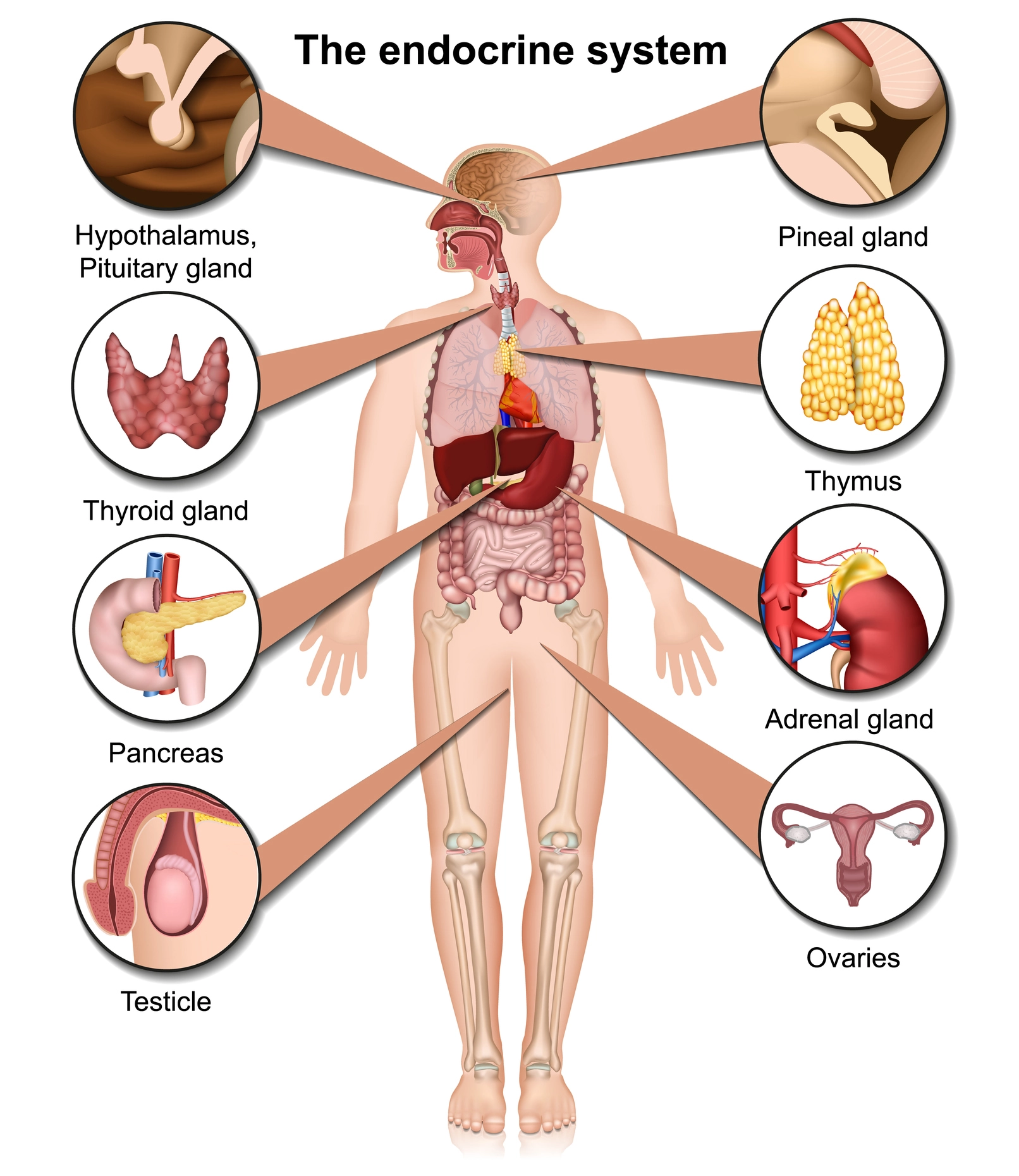 Brain Tumours