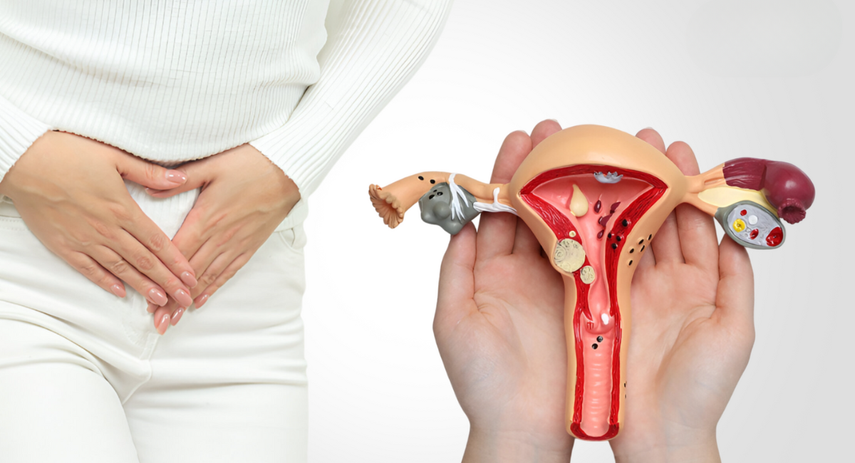 Intrauterine Insemination or IVF